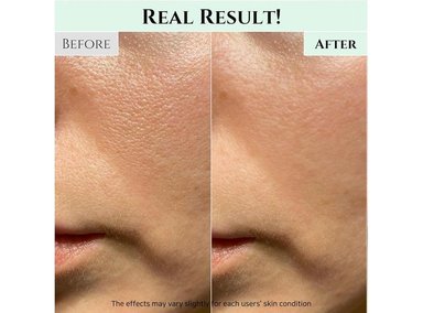 BEAUTY OF JOSEON LIMPIADOR GEL REFRESCANTE ANTI ACNÉ Y PUNTOS NEGROS 100ML - 6
