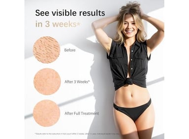 DEPILACIÓN LÁSER IPL SEGURO EN CASA PARA MUJERES Y HOMBRES, INDOLORO, CONTACTO FRÍO, RESULTADOS DURADEROS CUERPO COMPLETO Y ROSTR - 2