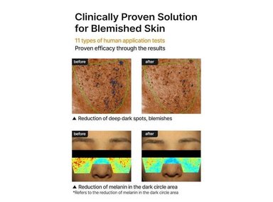 CREMA CELIMAX NIACINAMIDA ÁCIDO TRANEXÁMICO 35ML - 4