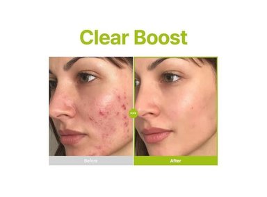 PURITO SERUM FACIAL AZELAICO 10% ARBOL DE TE KOJICO 30ML - 4