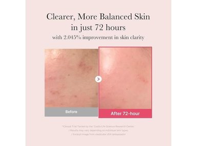 MEDICUBE SERUM TXA+NIACINAMIDE 15% 5% ÁCIDO TRANEXÁMICO SUERO 30ML - 2