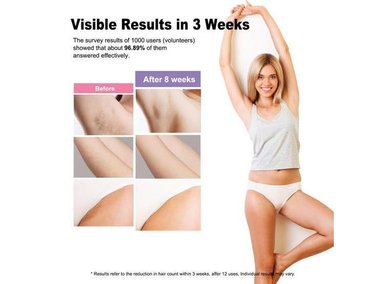 DEPILADORA LÁSER IPL CON 999,999 FLASHES PARA USO SEGURO Y EFICAZ EN TODO EL CUERPO. IDEAL PARA USO DOMÉSTICO - 4