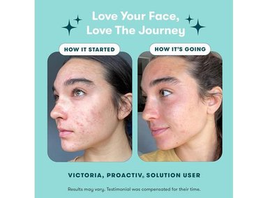 PROACTIV SISTEMA DE TRATAMIENTO DE ACNÉ EN 3 PASOS, 60ML - 2