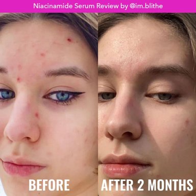 SERUM FACIAL GOOD MOLECULES NIACINAMIDE 30 ML - 3