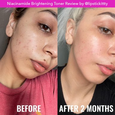 TRATAMIENTO FACIAL GOOD MOLECULES TONICO ILUMINADOR NIACINAMIDA 120 ML - 4