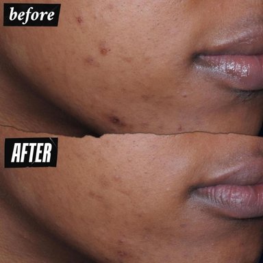 BLOQUEADOR BETTER SCREEN KIEHLS UV SERUM SPF 50+ - 50 ML - 5