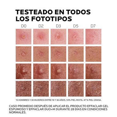 TRATAMIENTO FACIAL LA ROCHE POSAY EFFACLAR DUO+M ANTI-IMPERFECCIONES 40 ML - 3