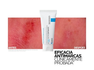 TRATAMIENTO FACIAL LA ROCHE POSAY CICAPLAST BALM B5+ ULTRA REPARADOR 40 ML - 2
