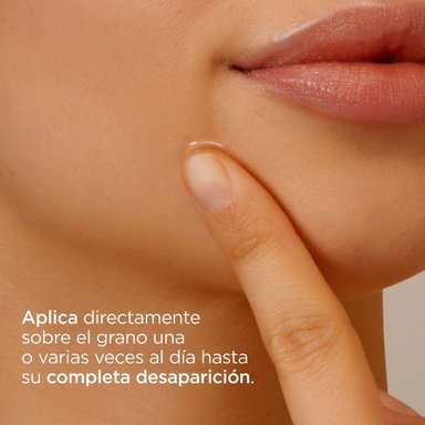 ISDIN ACNIBEN ON THE SPOT 15ML - GEL CORRECTOR DE GRANOS FACIALES LOCALIZADOS PARA PIEL GRASA/TENDENCIA ACNÉICA - 6