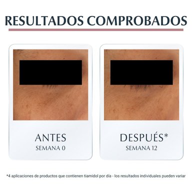 PACK X2 EUCERIN ANTIPIGMENT CONTORNO DE OJOS Y ANTIOJERAS 15ML - 5