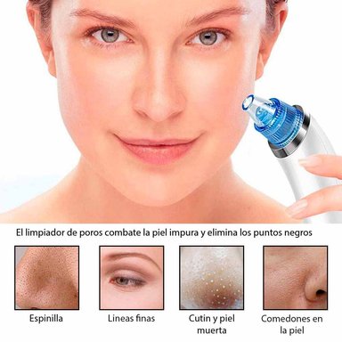 COMBO LIMPIADOR FACIAL + REMOVEDOR DE PUNTOS NEGROS - 3