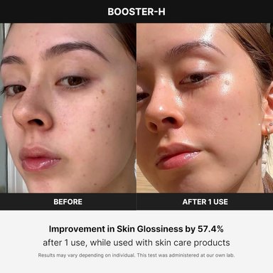 MEDICUBE BOOSTER H BEAUTY DEVICE - 3