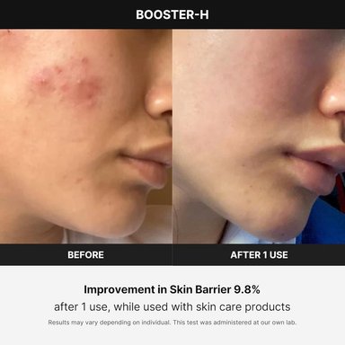 MEDICUBE BOOSTER H BEAUTY DEVICE - 4
