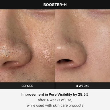 MEDICUBE BOOSTER H BEAUTY DEVICE - 5