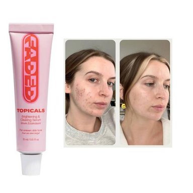 SKINCARE CREMA TOPICALS FADED PARA MANCHAS POST ACNE 15ML