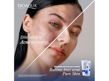 CREMA FACIAL BIO AQUA LIMPIADOR ACNE BIOAQUA PURE SKIN ANTI IMPERFECCIONES 100 GR - 5
