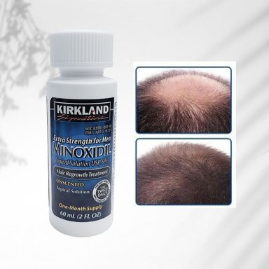 CUIDADO PERSONAL KIRKLAND MINOXIDIL LIQUIDO 5 X1FRASCO - 2