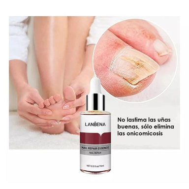 LANBENA NAIL REPAIR TRATAMIENTO PARA HONGOS EN UÑAS 15ML