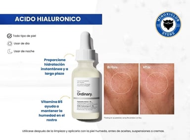PACK ACIDO GLICOLICO 100ML + ACIDO HIALURONICO THE ORDINARY - 4