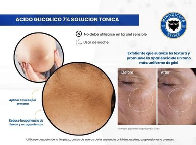 ACIDO GLICOLICO 7% + THE ORDINARY 100ML - 2