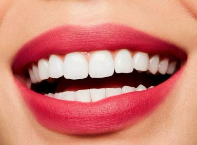 LABIAL MAC POWDER KISS LIQUID LIPCOLOUR BILLION $ SMILE - 4