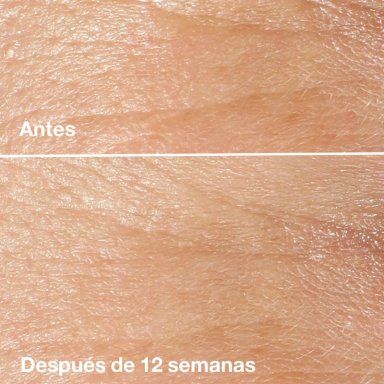 CONTORNO DE OJOS CLINIQUE PARA ANTIARRUGAS SMART CLINICAL REPAIR 15ML - 3