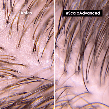 SHAMPOO EN GEL QUE PURIFICA EL CUERO CABELLUDO Y LA FIBRA DE RESIDUOS, SUDOR Y GRASA PARA UNA SENSACIÓN MÁS FRESCA Y LIMPIA SCALP ADVANCED ANTI-OILINESS 300 ML - 2