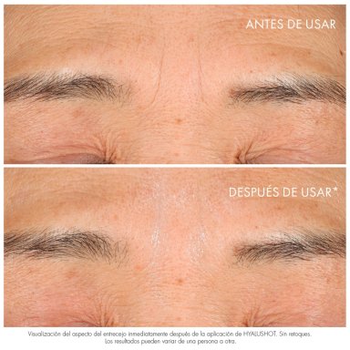 DIOR CAPTURE TOTALE HYALUSHOT 15ML - 4