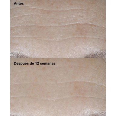 HIDRATANTE FACIAL CLINIQUE REPARADORA ANTIARRUGAS SMART CLINICAL REPAIR SPF30 50ML - 4