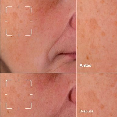 SUERO ROSTRO CLINIQUE 50ML EVEN BETTER CLINICAL ANTIMANCHAS - 11