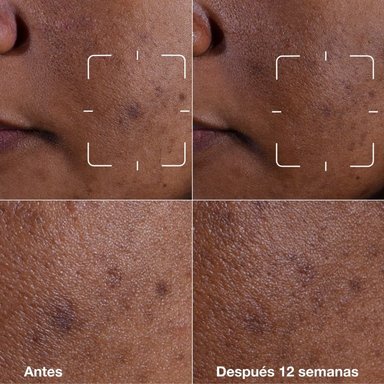 SUERO ROSTRO CLINIQUE 50ML EVEN BETTER CLINICAL ANTIMANCHAS - 10
