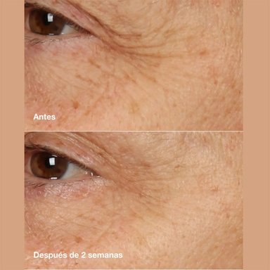 LOCIÓN CLARIFICADORA CLINIQUE ANTI-BLEMISH SOLUTIONS™ CLARIFYING LOTION - 5