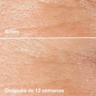SET DE-AGING EXPERTS CLINIQUE - 3