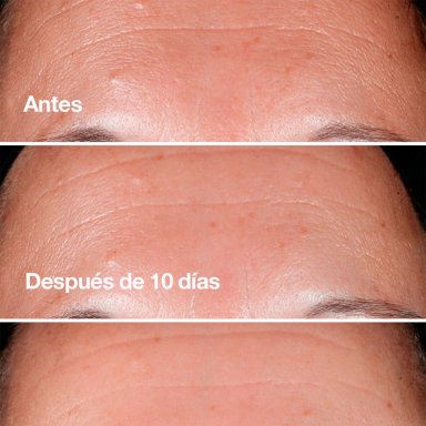 SET WRINKE FLIGHTING ROUTINE CLINIQUE - 3