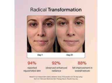 VARITA SOLAWAVE 4 EN 1 - MASAJE FACIAL, LUZ ROJA, CALOR Y CORRIENTE GALVÁNICA PARA REJUVENECIMIENTO - 3