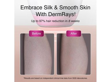 DEPILADORA LÁSER DERMRAYS PARA PIELES OSCURAS, TECNOLOGÍA 1064NM, REDUCE CRECIMIENTO DE CABELLO PERMANENTEMENTE - 5