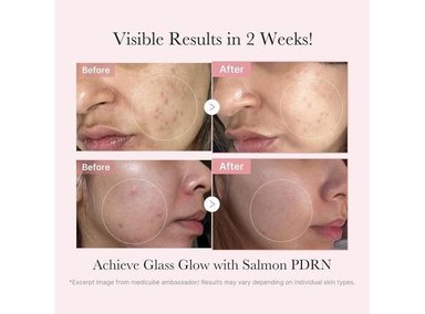 MEDICUBE KIT CON ADN DE SALMÓN PDRN TÓNICO SUERO Y MASCARILLA - 2
