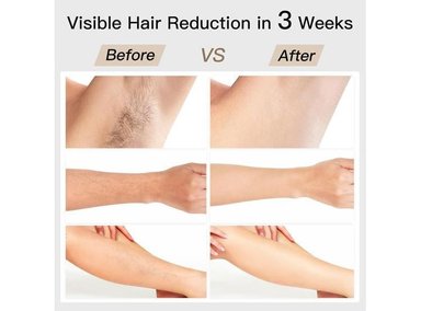 DEPILADORA IPL BOSIDIN, 6+1 MODOS, REJUVENECIMIENTO FACIAL, ENFRIAMIENTO DE HIELO, REDUCCIÓN DE VELLO PERMANENTE - 2