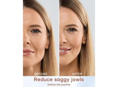 MLAY MÁQUINA DE BELLEZA RF, DISPOSITIVO PARA REDUCIR ARRUGAS Y ANTIENVEJECIMIENTO, USO EN CASA, EFECTOS DE SALÓN - 2