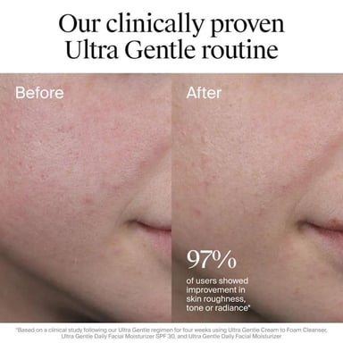 HIDRATANTE FACIAL DIARIO NEUTROGENA CON FPS 30 - 100 ML - 6
