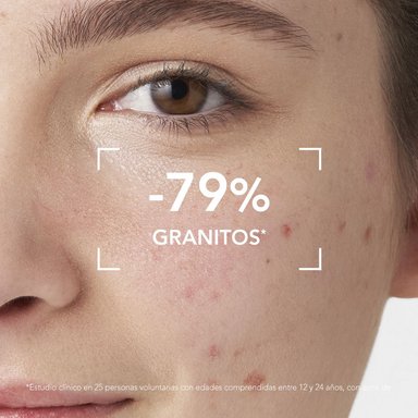 TRATAMIENTO BIODERMA SEBIUM GLOBAL 30 ML - 7