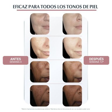 EUCERIN ANTIPIGMENTO SERUM DUAL 30ML - 4