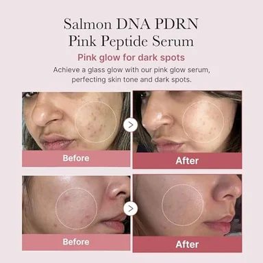 SET MEDICUBE SALMON DNA PDRN PINK PEPTIDE + ONE DAY AMPOULE 10 PZS - 2
