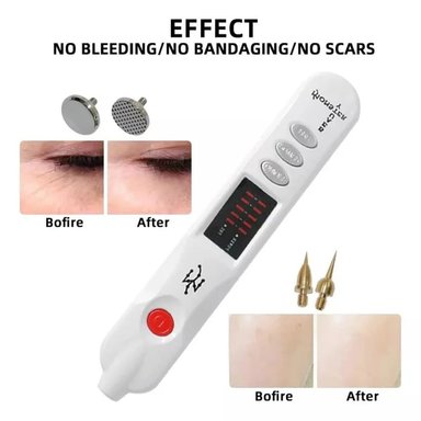 DEPILADORA FIBROBLAST PLASMA PEN - 4