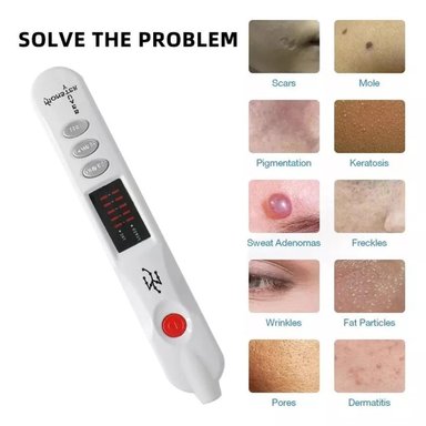 DEPILADORA FIBROBLAST PLASMA PEN - 6