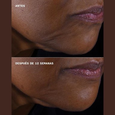 SET CLINIQUE CREMA SMART CLINICAL REPAIR LIFTING FACE & NECK 50ML - 3